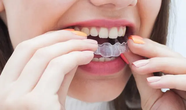 歯の矯正は医療費控除の適用になる？ 対象となる条件とは