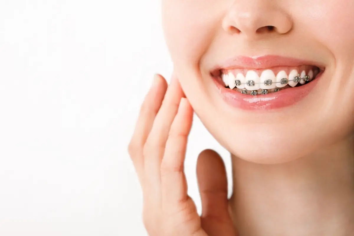 歯並びをきれいにしたい！「矯正歯科」で保険適用になるケースとは？