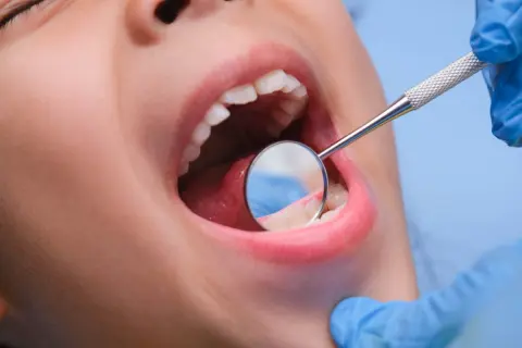 「歯医者」を受診する「頻度」はどのくらいが一般的？ 一回あたりの「診療料金」についても解説