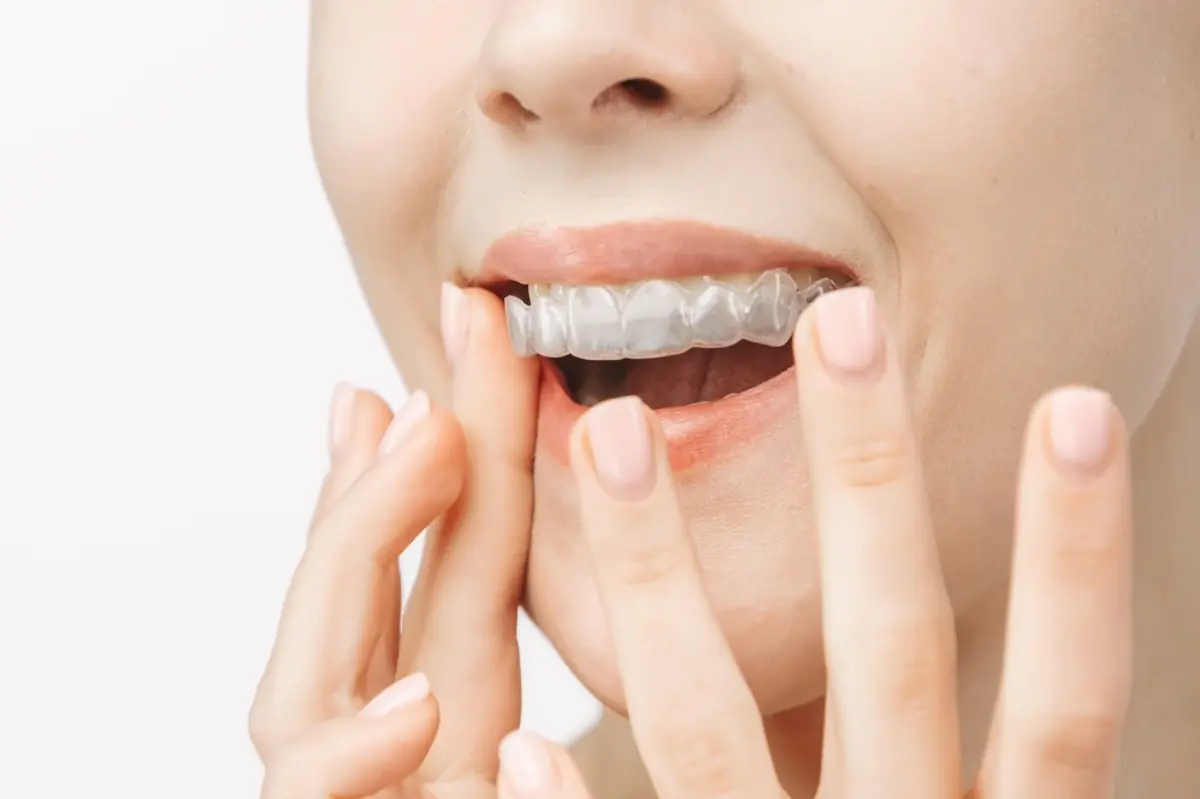 歯の矯正費用が「100万円」！？ 高額な治療費のローンを組む前にどのような対策をすればよい？