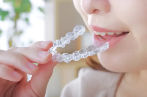 「マウスピース矯正”990円”から始められる」という広告を発見！ 矯正に興味があるのですが、最終的にどのくらいの金額がかかりますか？