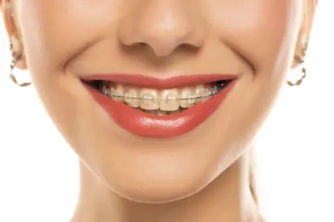 妻が「180万円」を“歯科矯正”に一括払い！「年末調整前ならお得」とのことですが、本当でしょうか？「年収490万円」で“戻ってくる金額”を試算