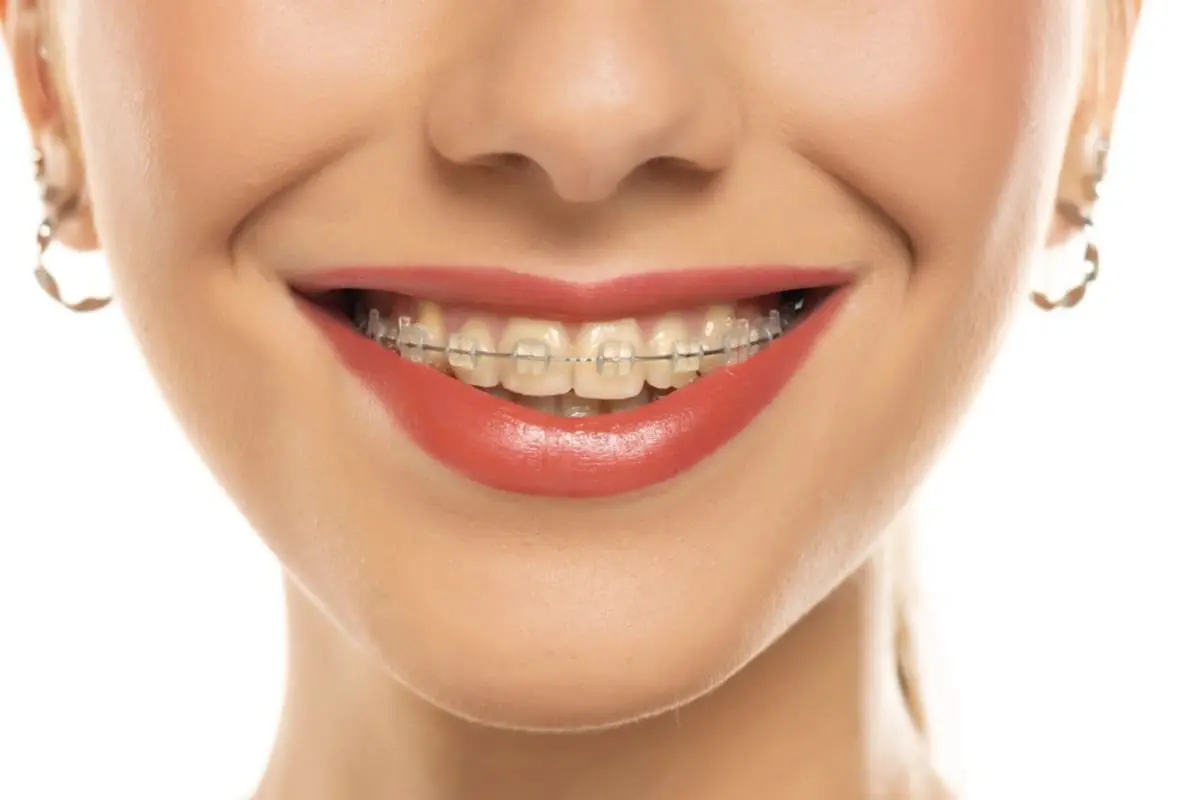 妻が「180万円」を“歯科矯正”に一括払い！「年末調整前ならお得」とのことですが、本当でしょうか？「年収490万円」で“戻ってくる金額”を試算