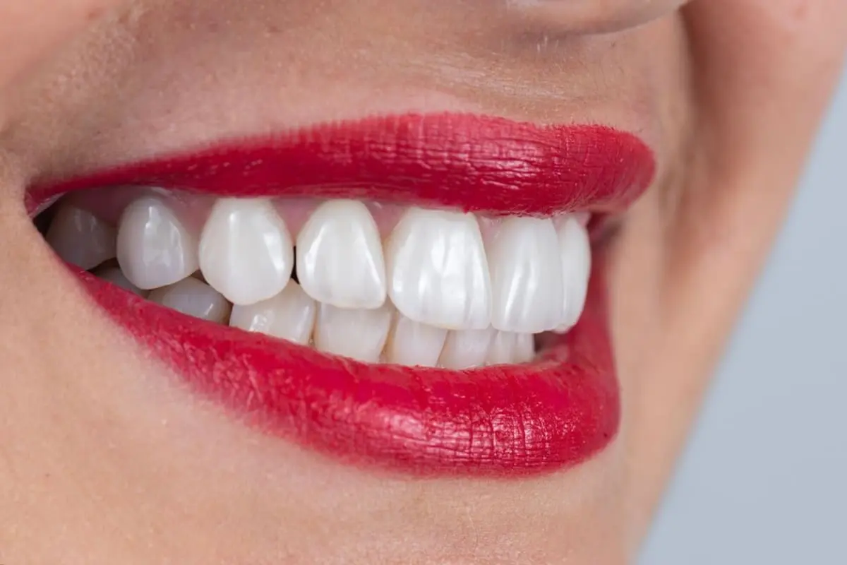 今年、母の還暦祝いで“インプラント”費用を兄弟3人で割り勘でプレゼントします。78万円かかるそうですが、確定申告は必要ですか？また申告は誰がするのがよいでしょうか？