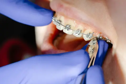 娘の歯列矯正に「80万円」。美容目的だと還付金は「ゼロ」なのでしょうか？