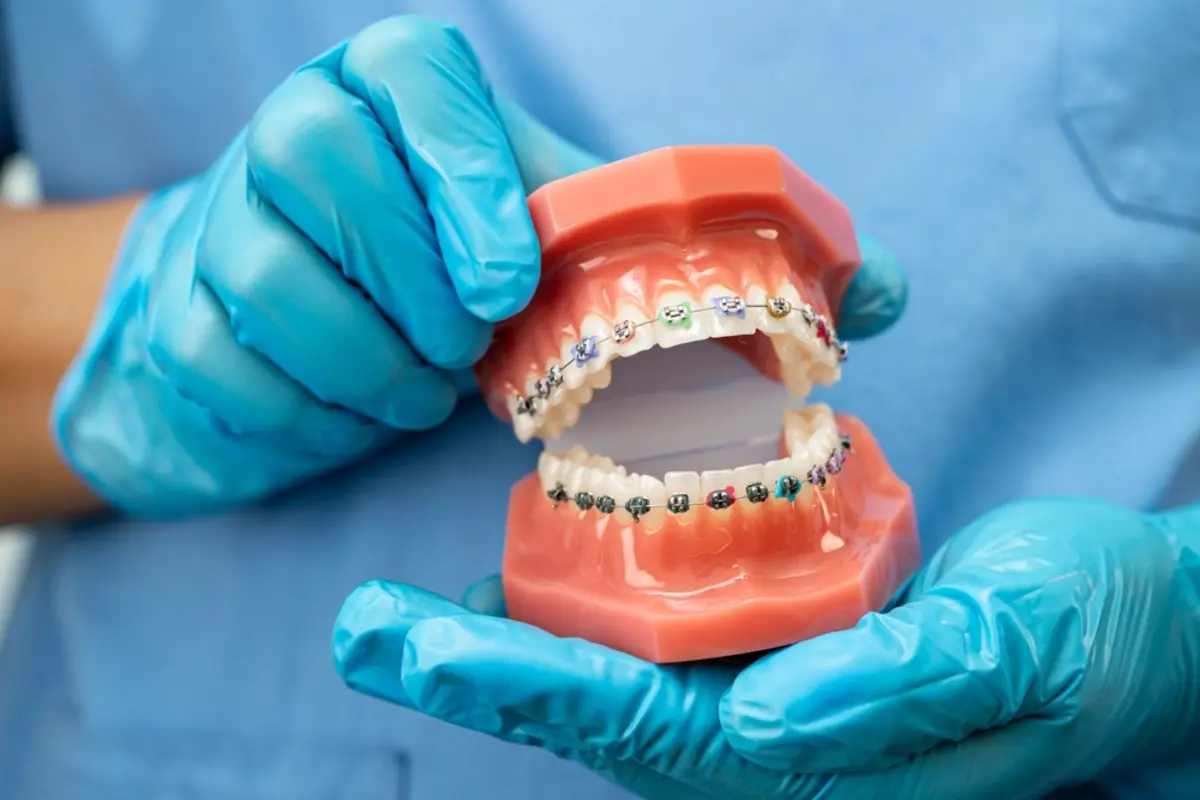 歯列矯正は高いので諦めていましたが、医療費控除が使えると聞きました。審美目的でも大丈夫ですか？