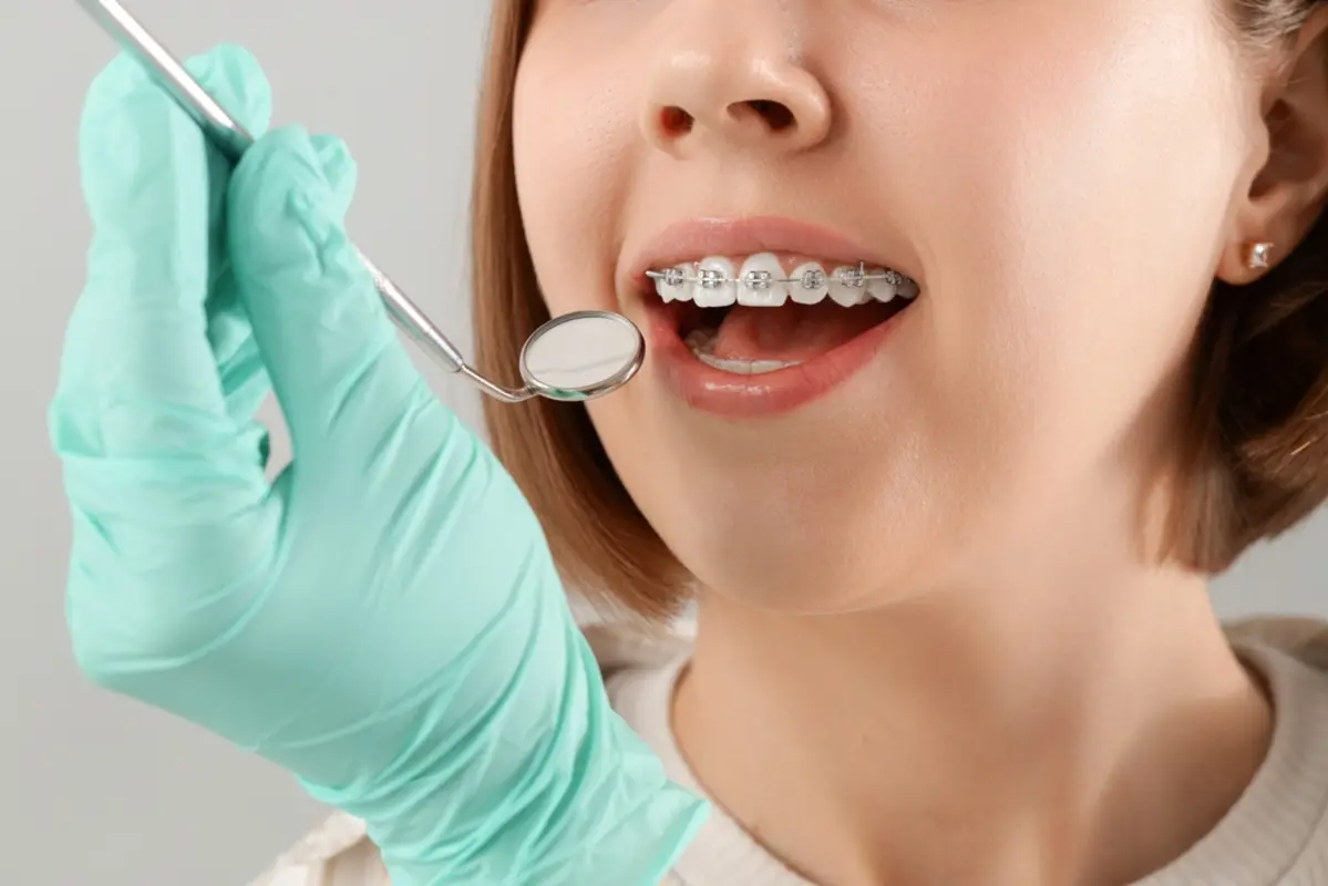 歯列矯正に「110万円」かかりました。治療のためでも、大人の矯正だと医療費控除の対象外になることはあるのでしょうか？